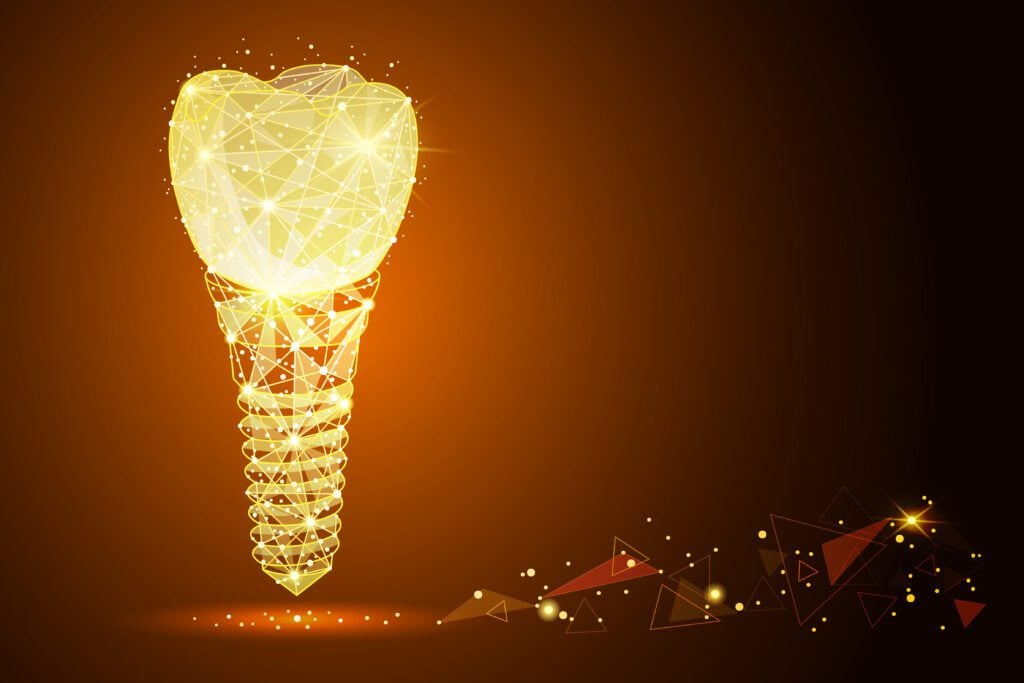 dental implants