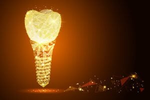 dental implants