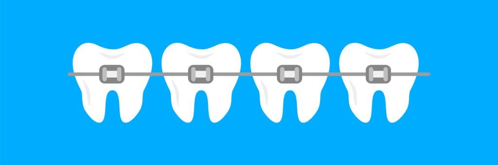 orthodontist near me