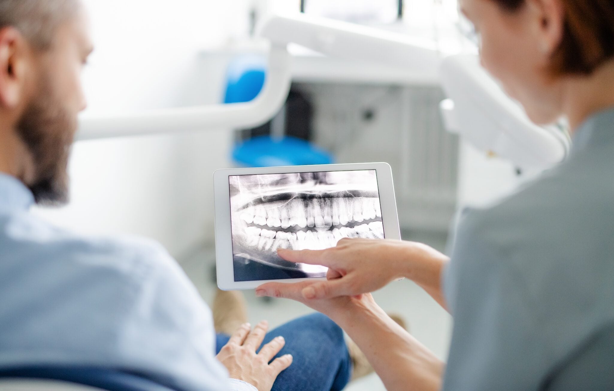 wisdom teeth removal in Shoreline