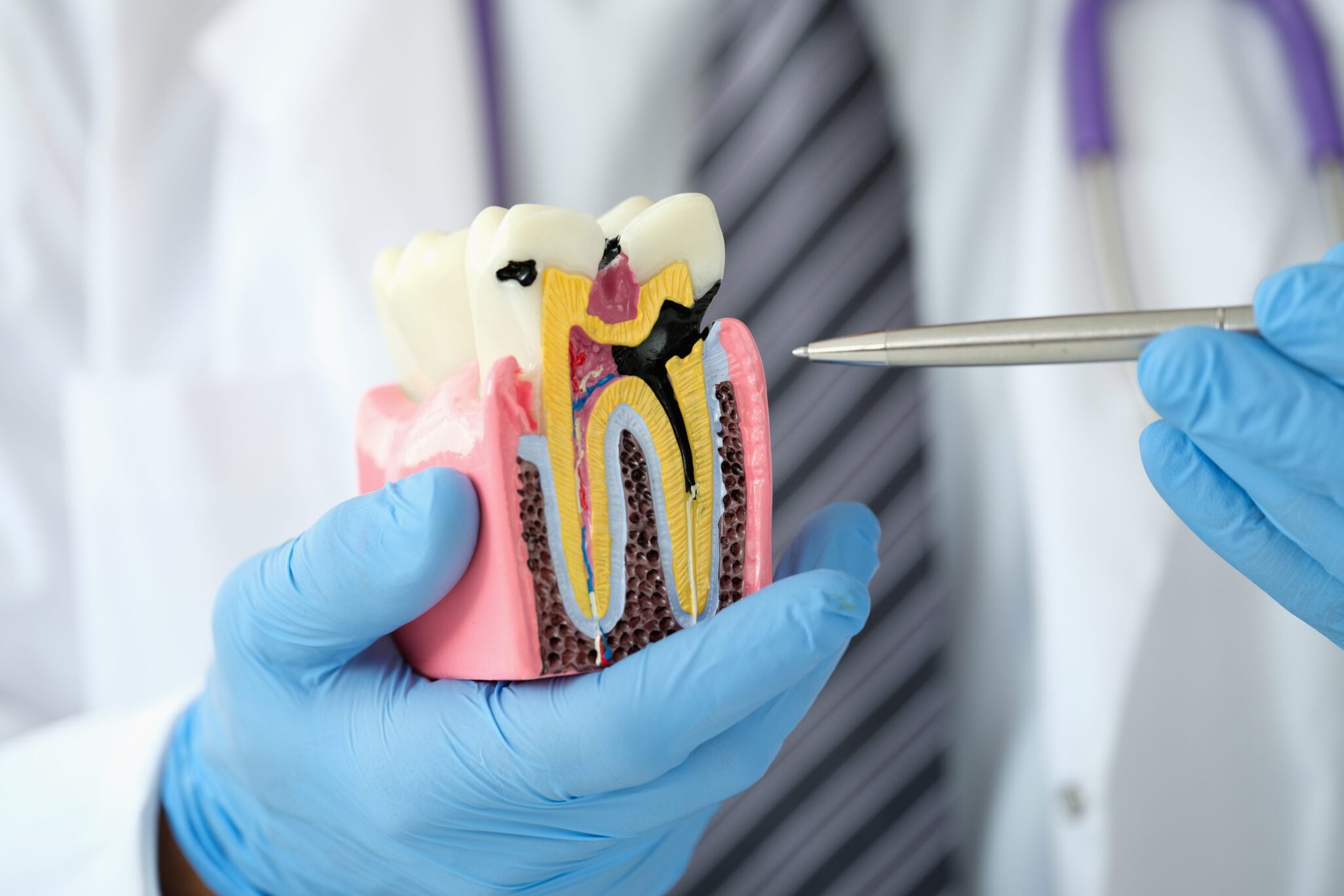 family dentist in Shoreline
